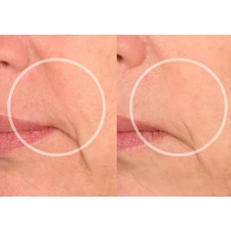 Kit Lift Care® - Sorriso