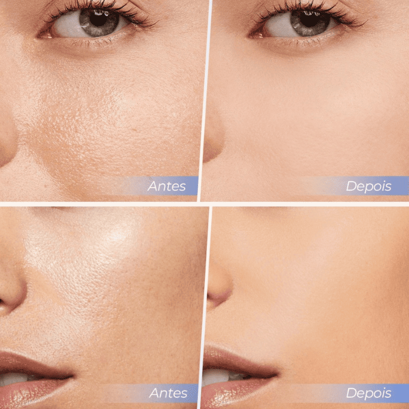 Pó Facial Antirrugas e Matificante - SACE LADY