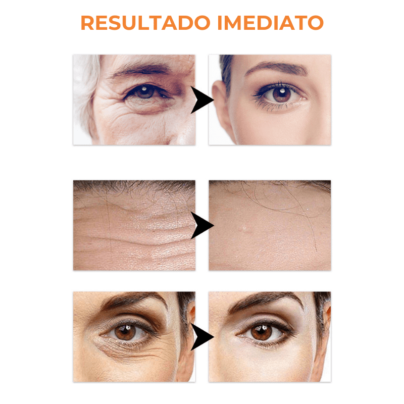 KIT Collagen Skin Botox™