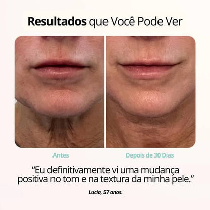 Rejuvenix -  Terapia de ions vermelhos ajudam a manter a pele jovial e firme