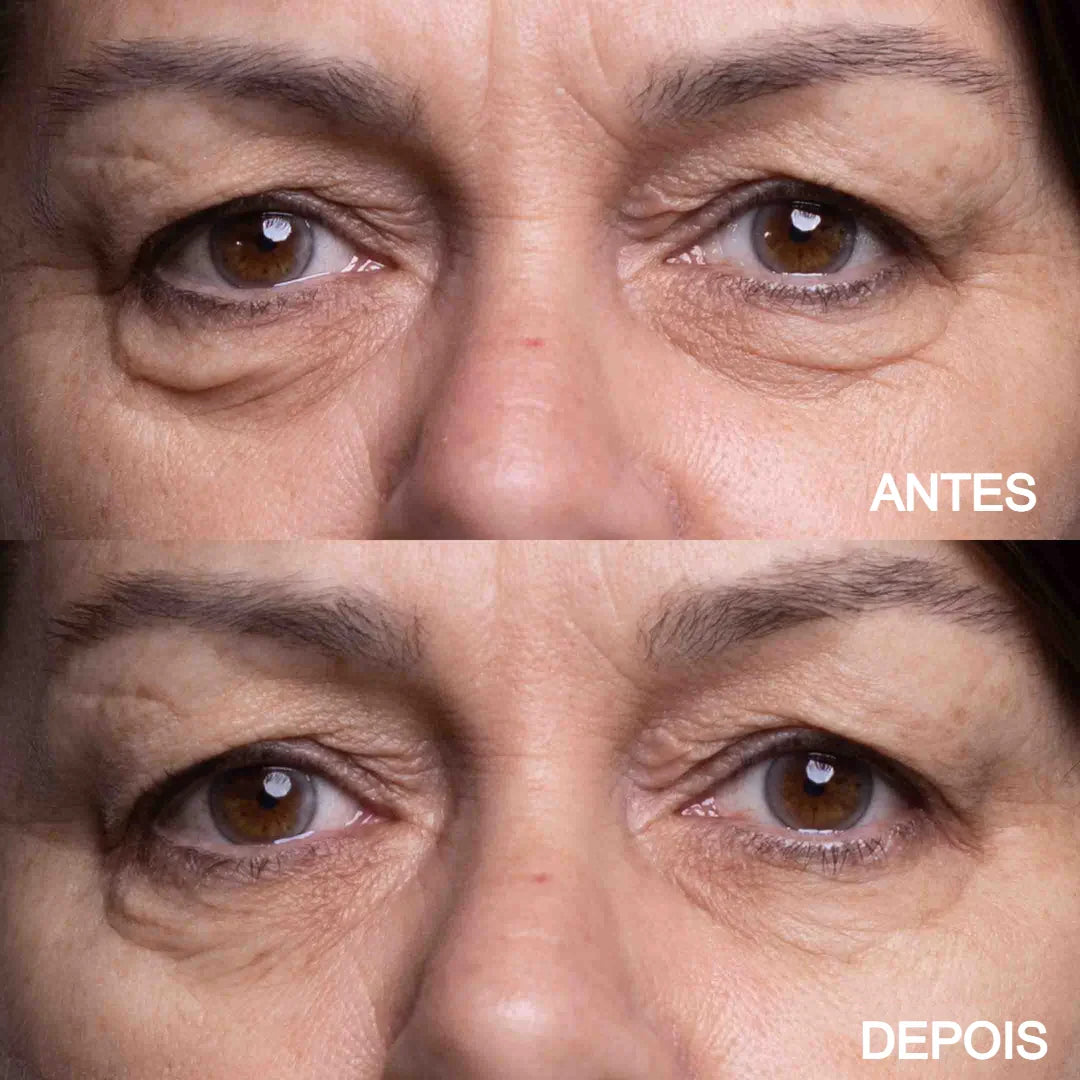 Kit Lift Care® - Olhos