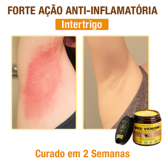 LOVILDS™ Creme Total com Veneno de Abelha – Testado e Aprovado por Especialistas nos EUA