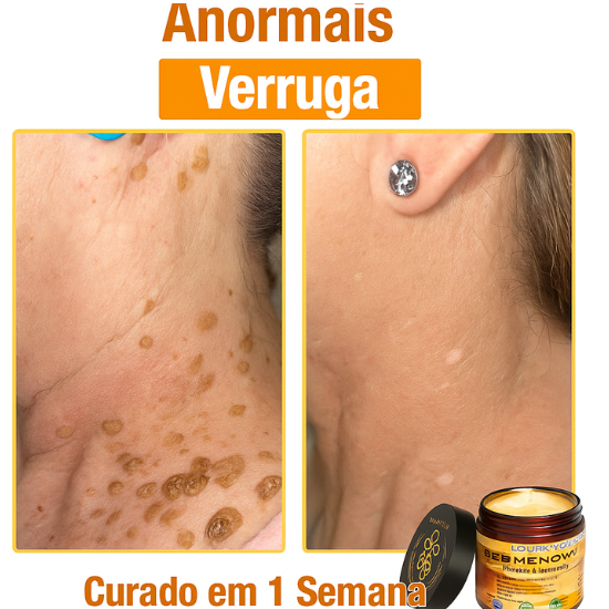 LOVILDS™ Creme Total com Veneno de Abelha – Testado e Aprovado por Especialistas nos EUA
