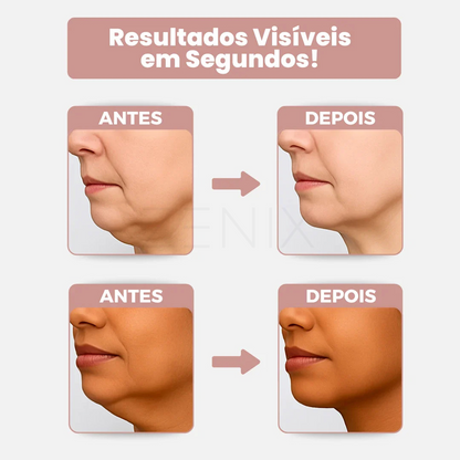 Belle Lift - Adesivo Lifting Antirrugas e Contra Flacidez no Pescoço