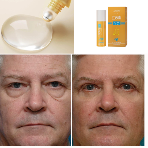 Roll-On 5 em 1 Ultra Rejuvenescedor Luteína Glow