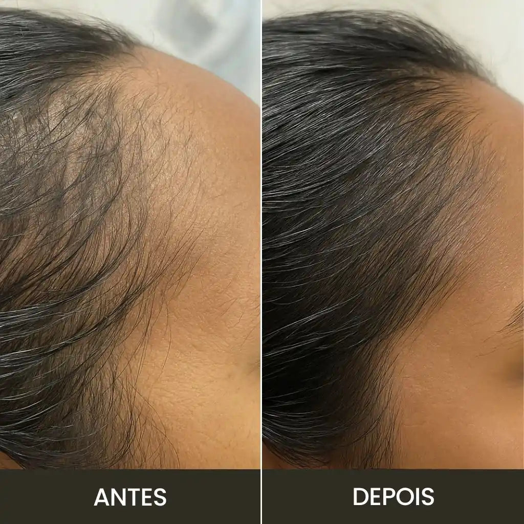 Kit Anti-Queda | Escova RevitaBrush & Óleo de Alecrim