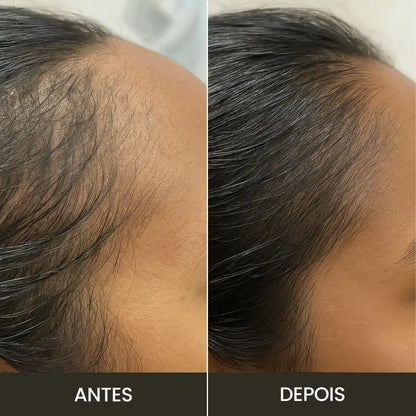 Kit Anti-Queda | Escova RevitaBrush & Óleo de Alecrim