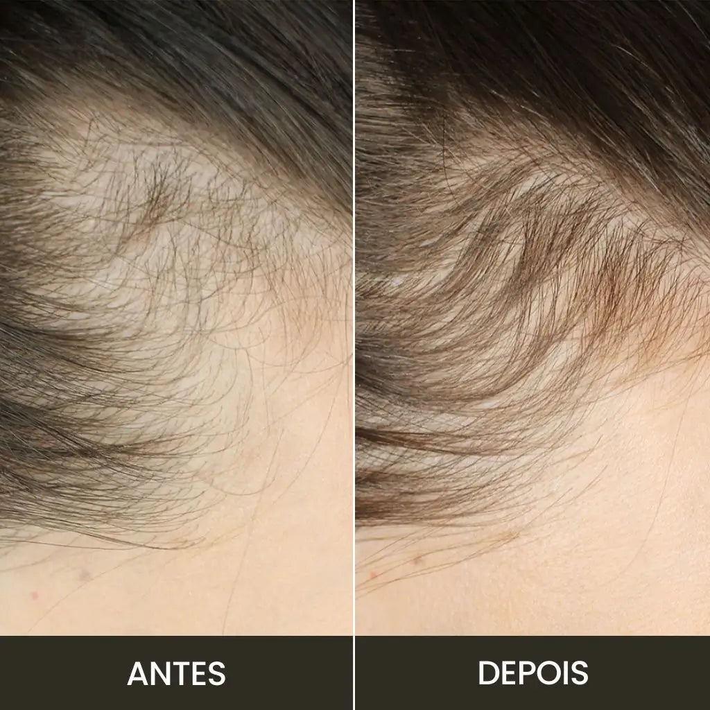 Kit Anti-Queda | Escova RevitaBrush & Óleo de Alecrim