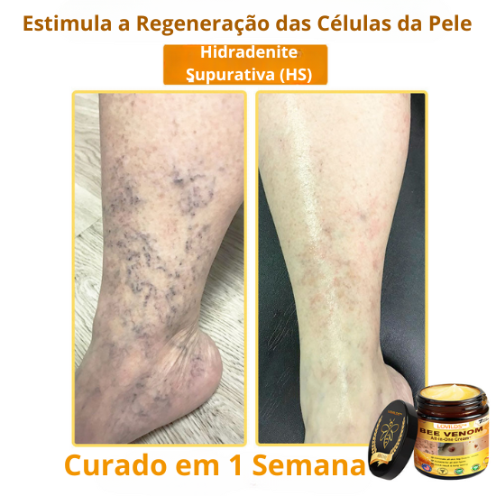 LOVILDS™ Creme Total com Veneno de Abelha – Testado e Aprovado por Especialistas nos EUA