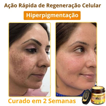 LOVILDS™ Creme Total com Veneno de Abelha – Testado e Aprovado por Especialistas nos EUA