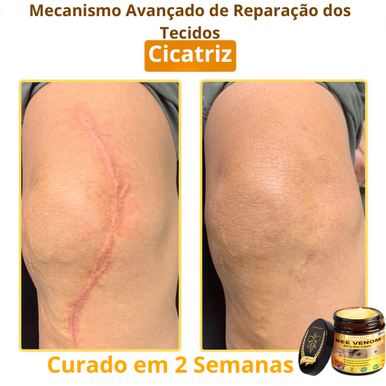 LOVILDS™ Creme Total com Veneno de Abelha – Testado e Aprovado por Especialistas nos EUA