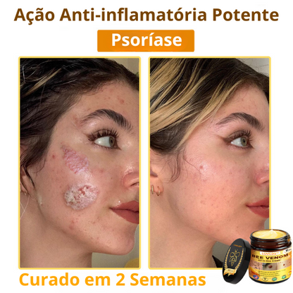 LOVILDS™ Creme Total com Veneno de Abelha – Testado e Aprovado por Especialistas nos EUA