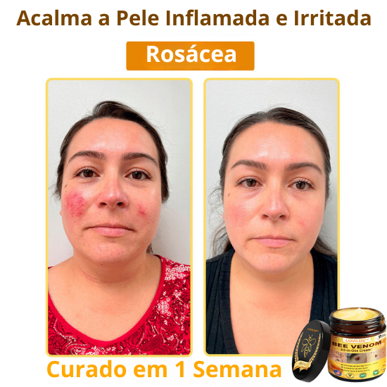LOVILDS™ Creme Total com Veneno de Abelha – Testado e Aprovado por Especialistas nos EUA