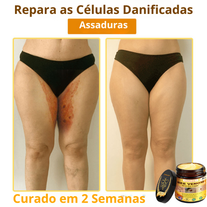 LOVILDS™ Creme Total com Veneno de Abelha – Testado e Aprovado por Especialistas nos EUA