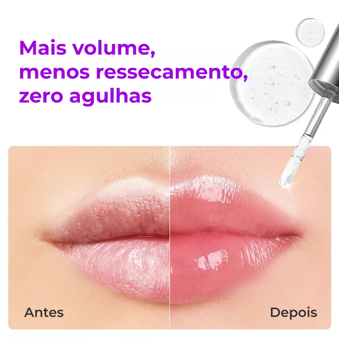 SpiculeShot – Tecnologia Coreana Que Aumenta o Volume e Deixa Efeito Preenchido