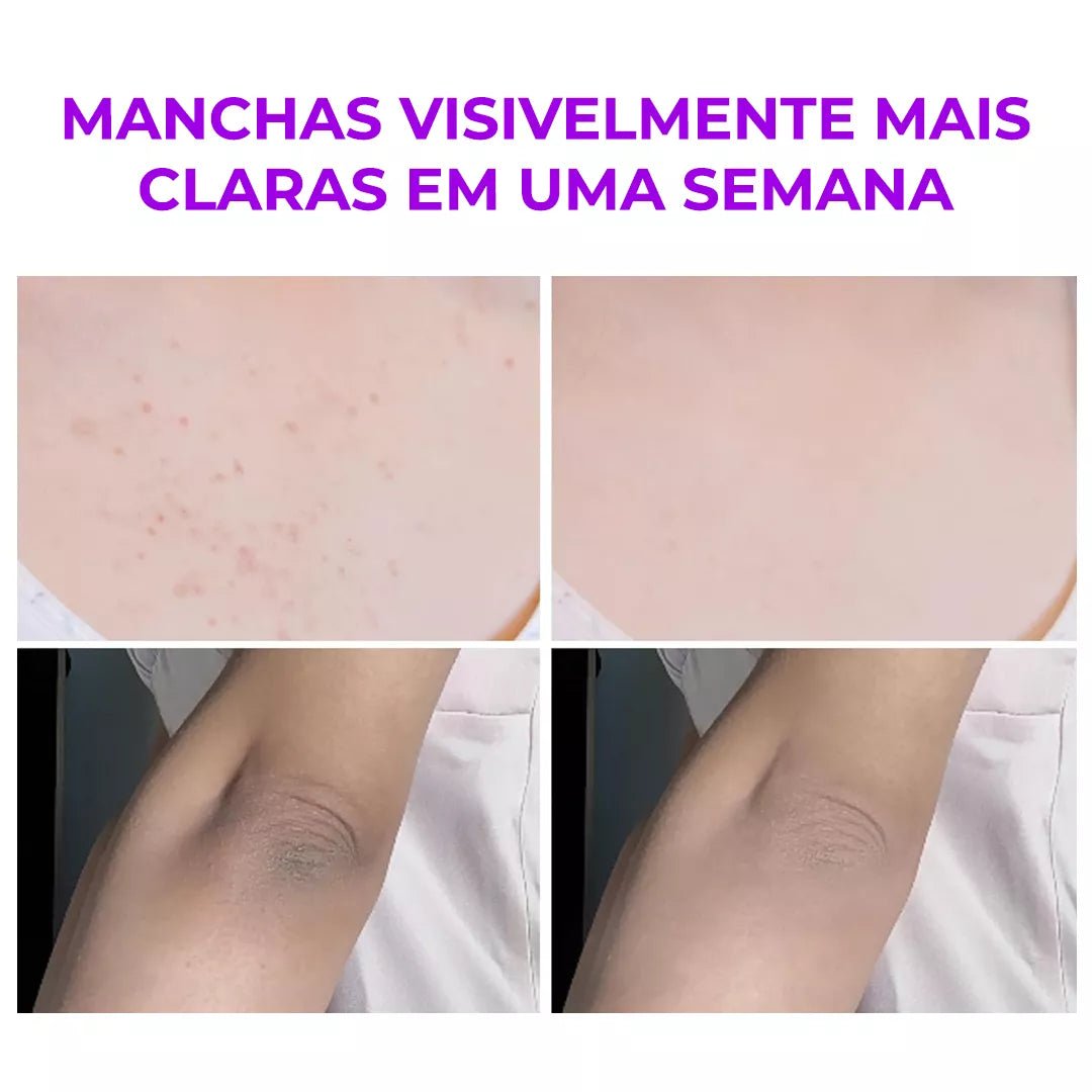 Melashot – Esfoliante Que Clareia Manchas em minutos