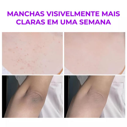 Melashot – Esfoliante Que Clareia Manchas em minutos