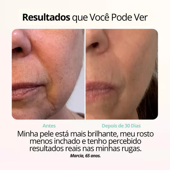 Rejuvenix -  Terapia de ions vermelhos ajudam a manter a pele jovial e firme