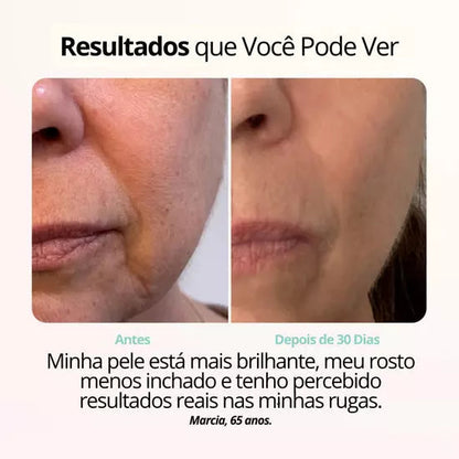 Rejuvenix -  Terapia de ions vermelhos ajudam a manter a pele jovial e firme