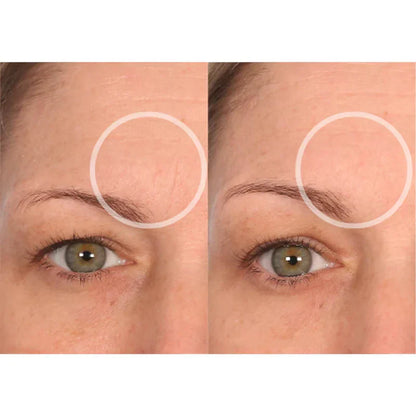 Kit Lift Care® - Testa